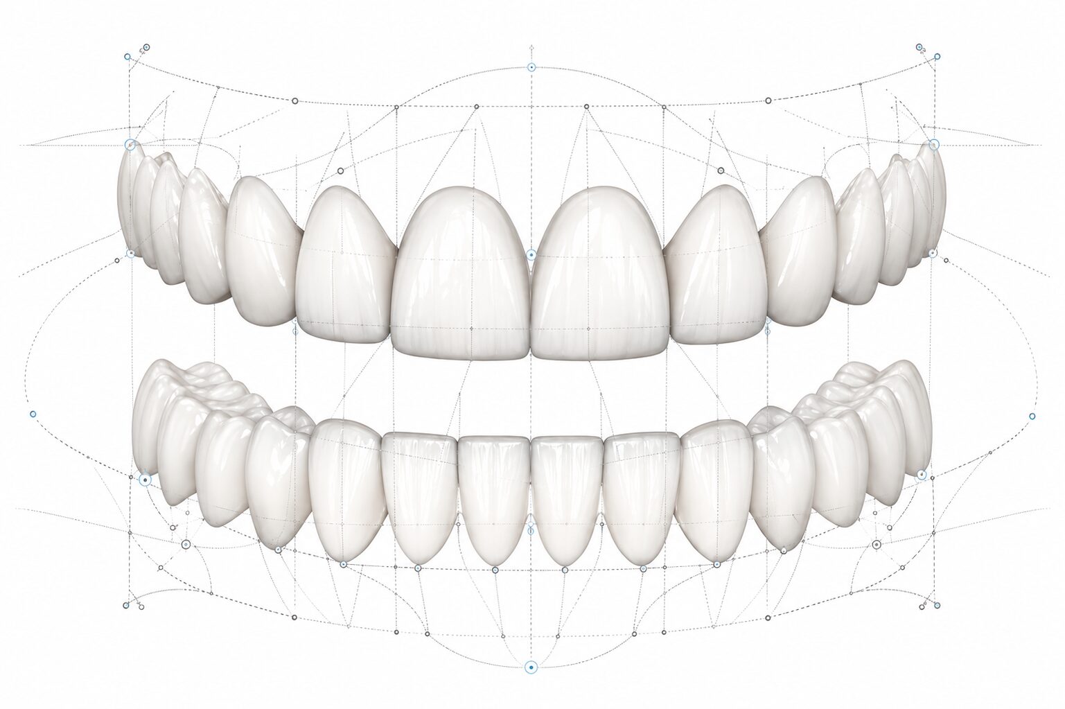 Digital smile design schema showing upper and lower dental arches with planning guide lines